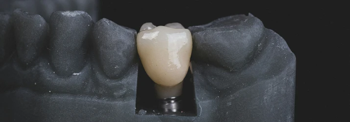 FC – Dental Implants at Central Washington Oral & Facial Surgery